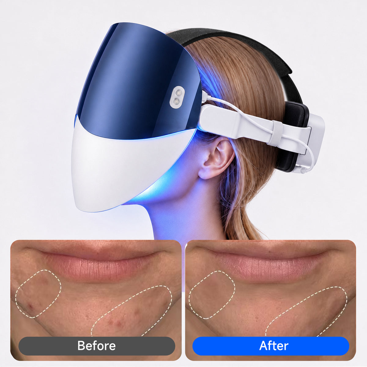 Lovetenet A097 · Premium LED Face Mask